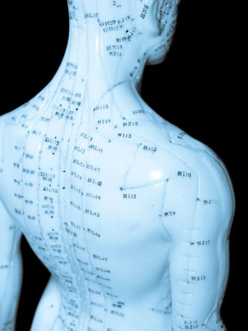 Acupuncture for Pain Reflief
